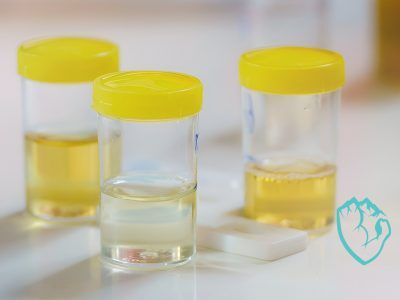 How-Long-is-MK-677-Detectable-in-Urine